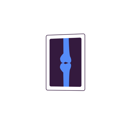 Knie-Röntgen