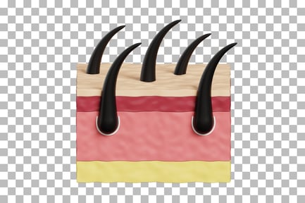 Preview: Skin