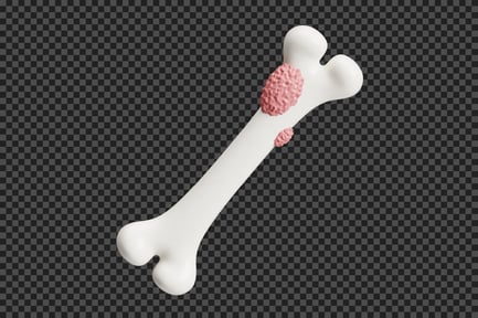 Preview: Bone Cancer