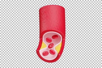 Preview: Blood Vessel with Fat