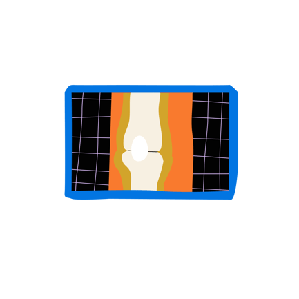 Knie-Röntgen