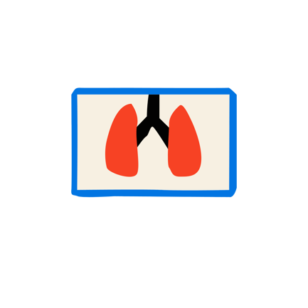 Lung Scan