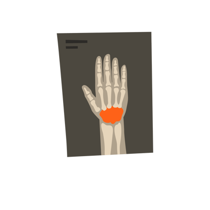 Os