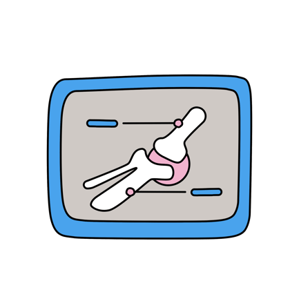 Joint X-Ray Analysis