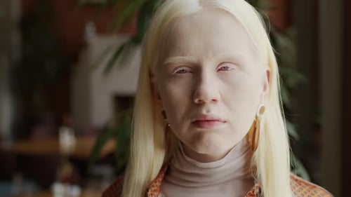 Beautiful Woman With Albinism Close-up Portrait