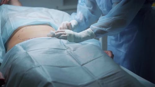 Medical Procedure in Hospital Setting