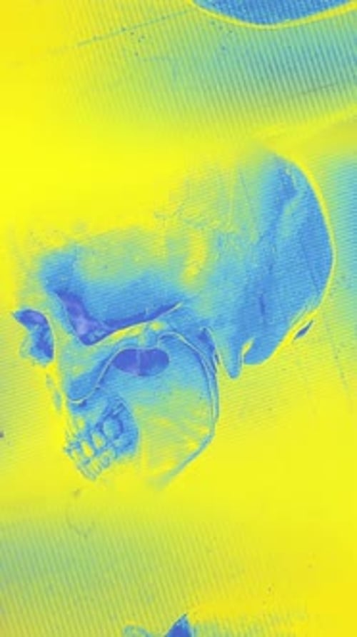 Medical Chart Skull 06