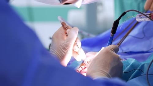 Surgical procedure with gloved hands using medical instruments