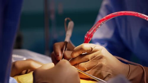 Surgeons Perform Delicate Medical Procedure in Operating Room