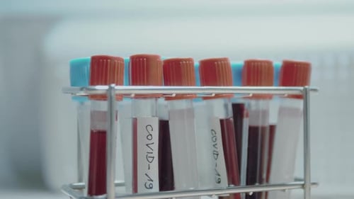 Blood samples in test tubes labelled COVID-19
