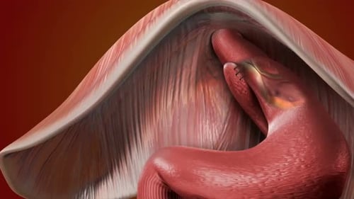 Animated 3D Medical Visualization of Stomach Surgical Repair