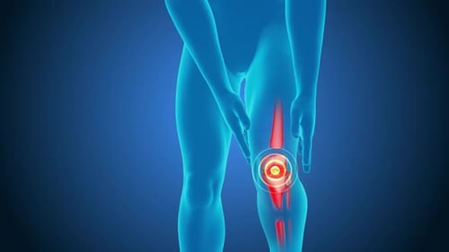 3D Human Anatomy Showing Knee Pain Animation
