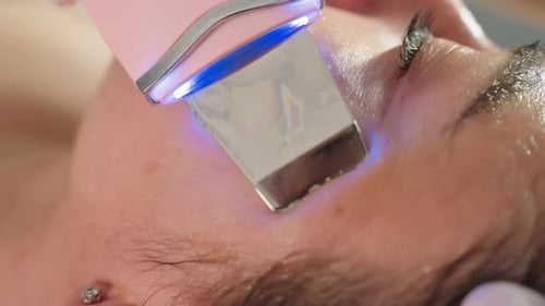 Female Specialist Extracts Pimples with Ultrasonic Spatula During Spa Treatment
