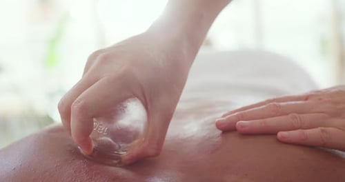 Massage Therapist using Massage Cup on Person's Back