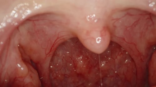 Examen des zones situées à l'intérieur de la bouche de la femme, glisse sur la langue et ressort. Macro