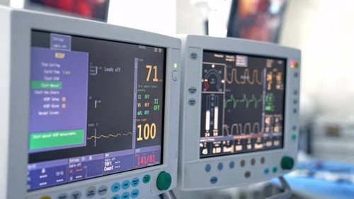 Monitors in hospital theater. Medical vital signs monitors in a hospital. Anesthesia surgery monitor
