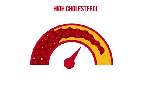 Cholesterol gauge showing rising lipid level inside blood vessel for medical
