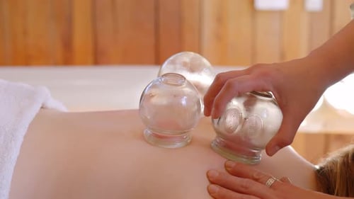physiotherapist performing cupping therapy on the back of a patient, the therapist is removing a suc