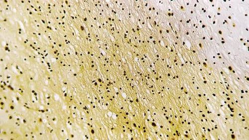 Silvering Cerebrum in Section of Human Being Filmed Under Microscope with 200x Magnification