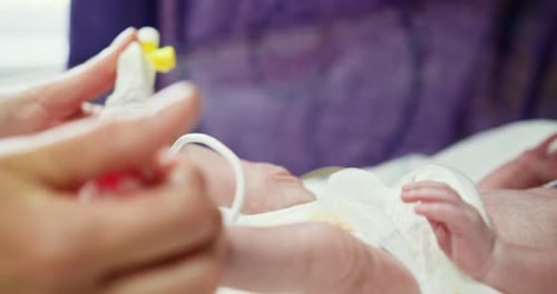 Tiny Infant Receiving Medical Care in Hospital Incubator