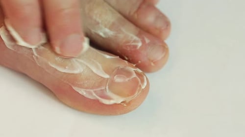 Cream Applied to Foot and Toes