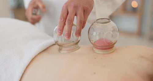 Relax, cupping treatment and back massage at a wellness, healing and beauty spa at resort