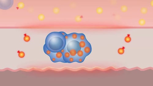 3D Medical Animation of Foam Cell and Lipid Pool Formation