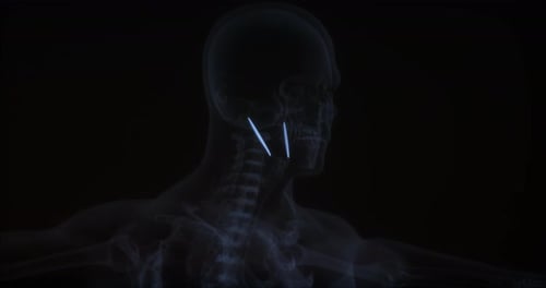 Human Head X-Ray Scan with Glowing Neural Activity