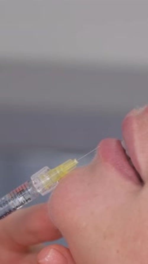 Medical Professional Injecting Lip with Filler