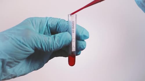 Hand Drips Liquid into Medical COVID-19 Test Vial