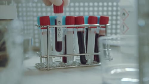 Test Tubes of Blood in a Medical Lab