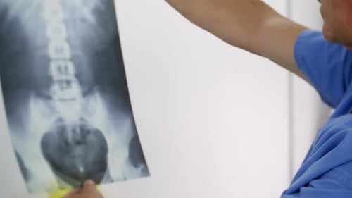 Un médico que lleva un uniforme azul examina la transparencia de una radiografía. El hombre sostiene la radiografía frente a la luz t