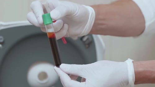 Medical Professional Holds Test Tube with Blood Sample