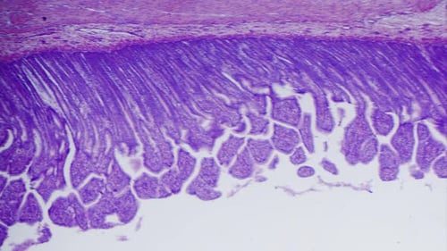 large intestine transverse section