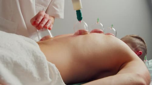 Cupping Therapy Treatment on Patient's Back