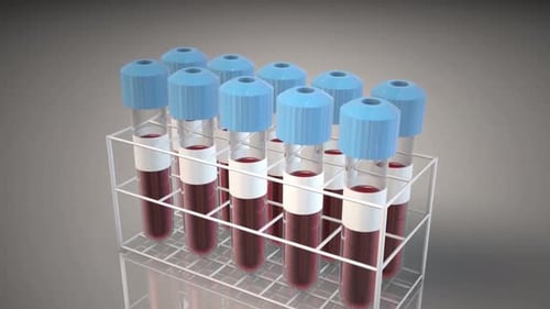 Animated Blood Sample Vials in a Laboratory Rack