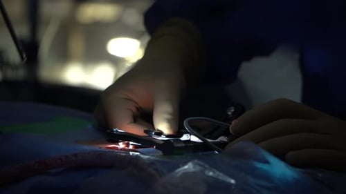 Surgeons Perform Delicate Operation in Operating Room