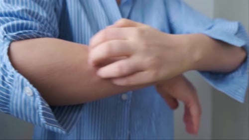 Nahaufnahme einer kratzenden Hand auf der Haut, frühe Anzeichen einer Nahrungsmittelallergie, Rötung und Schwellung
