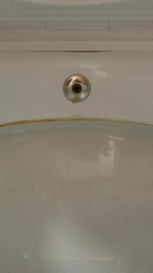 Vertical video. The camera slowly pulls away from the toilet as the lids close smoothly. Dolly slide