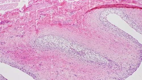 Transitional Epithelium of Man in Section Filmed Under Microscope 100x on Bright Field