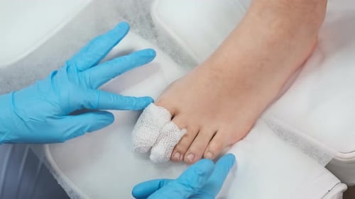 Podiatrist Examines Injured Foot with Gauze Wrapped Toes