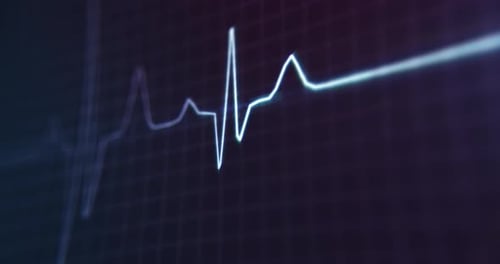 EKG - Heartbeat Monitor - 4K