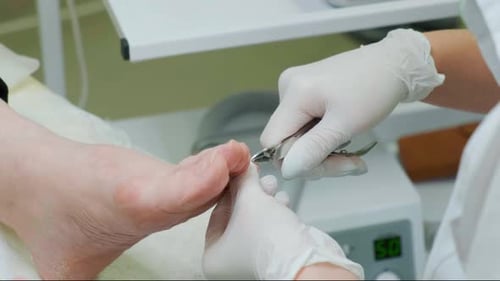Nail Clipping on a foot in the Hospital