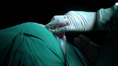 Rhinoplasty procedure and stitching doctor, end of operation.. Rhinoplasty procedure performed by a