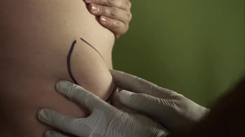 M49, Der Arzt untersucht den Tumor am Körper des Patienten. Ärztliche Untersuchung und Beratung.