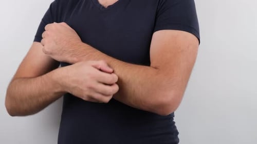 man itching skin allergy