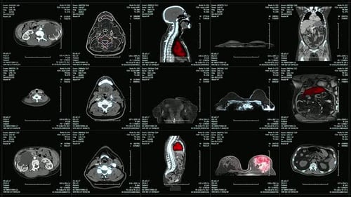 Medical Imaging Analysis Showing Multiple Crosssectional Views