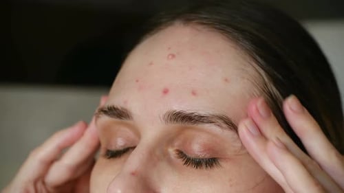 Closeup of Skin Irritation Macro Shot Capturing Emotional Response to Skin Blemishes and Discomfort