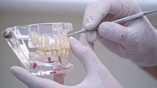 Dental Model Examined with Tool in Close Up