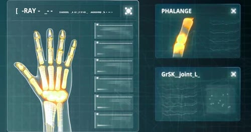 Futuristic X-Ray Scan Medical Interface Display with Diagnostic Data